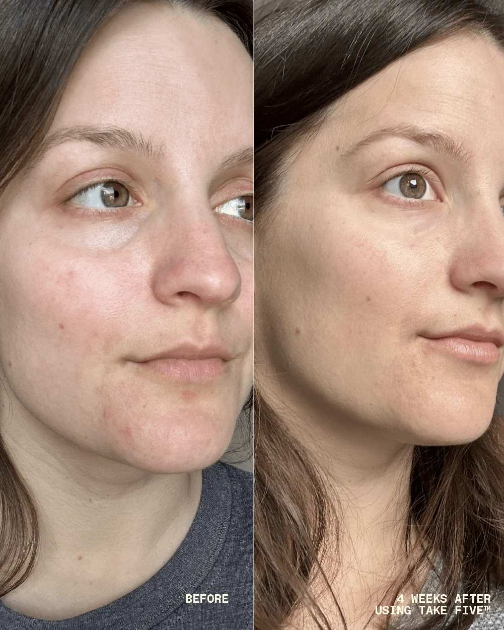 Take Five™ Hypochlorous Acid Balancing Body + Face Spray - Image 6